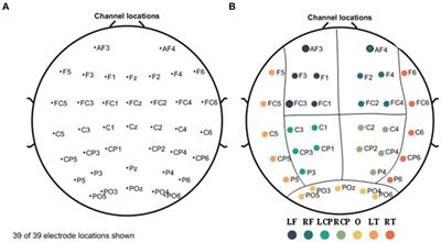 Recognition of regions of stroke injury using multi-modal frequency features of electroencephalogram